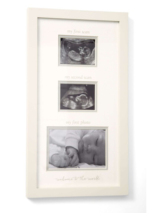 Welcome to the World - Double Scan Frame image number 1